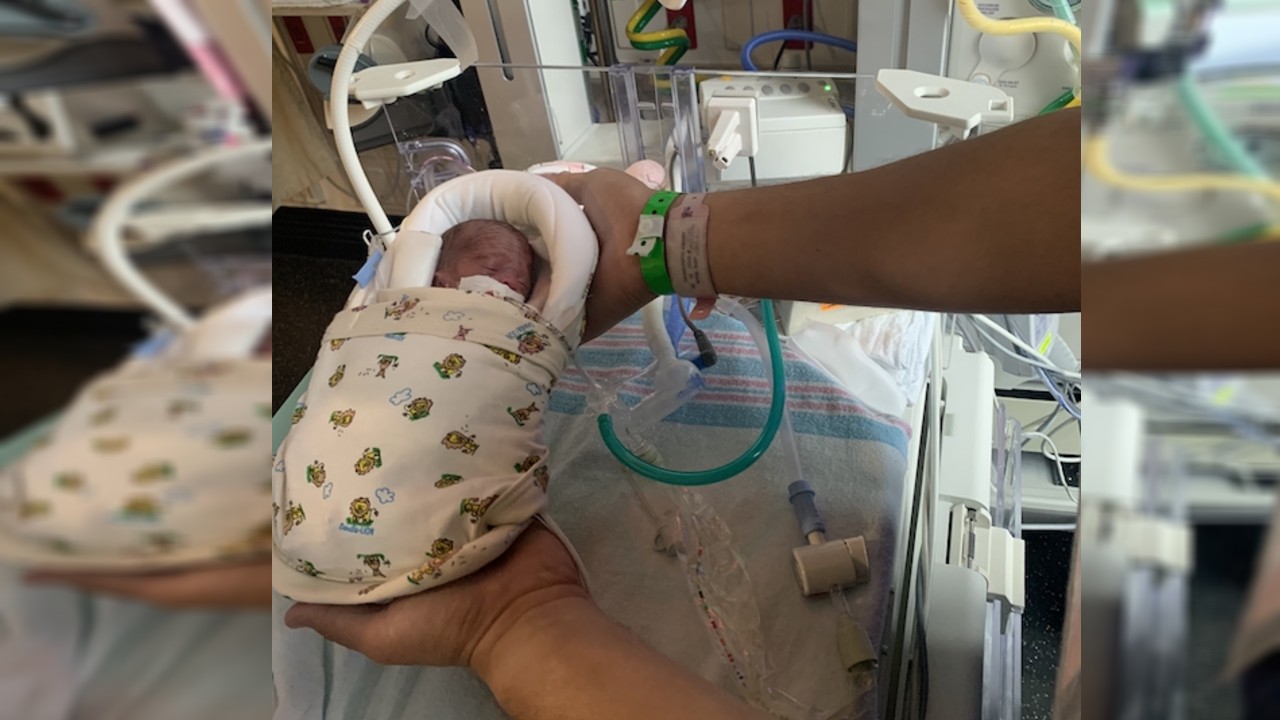 Teeny, weenie 12-oz. Florida baby added to 'Tiny Baby Registry'