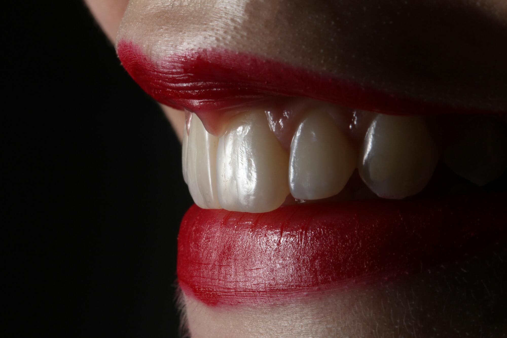 Get a healthy, bright smile like your favorite country music star